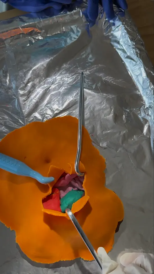 Locating the green play-dough gallbladder under the brown play-dough liver