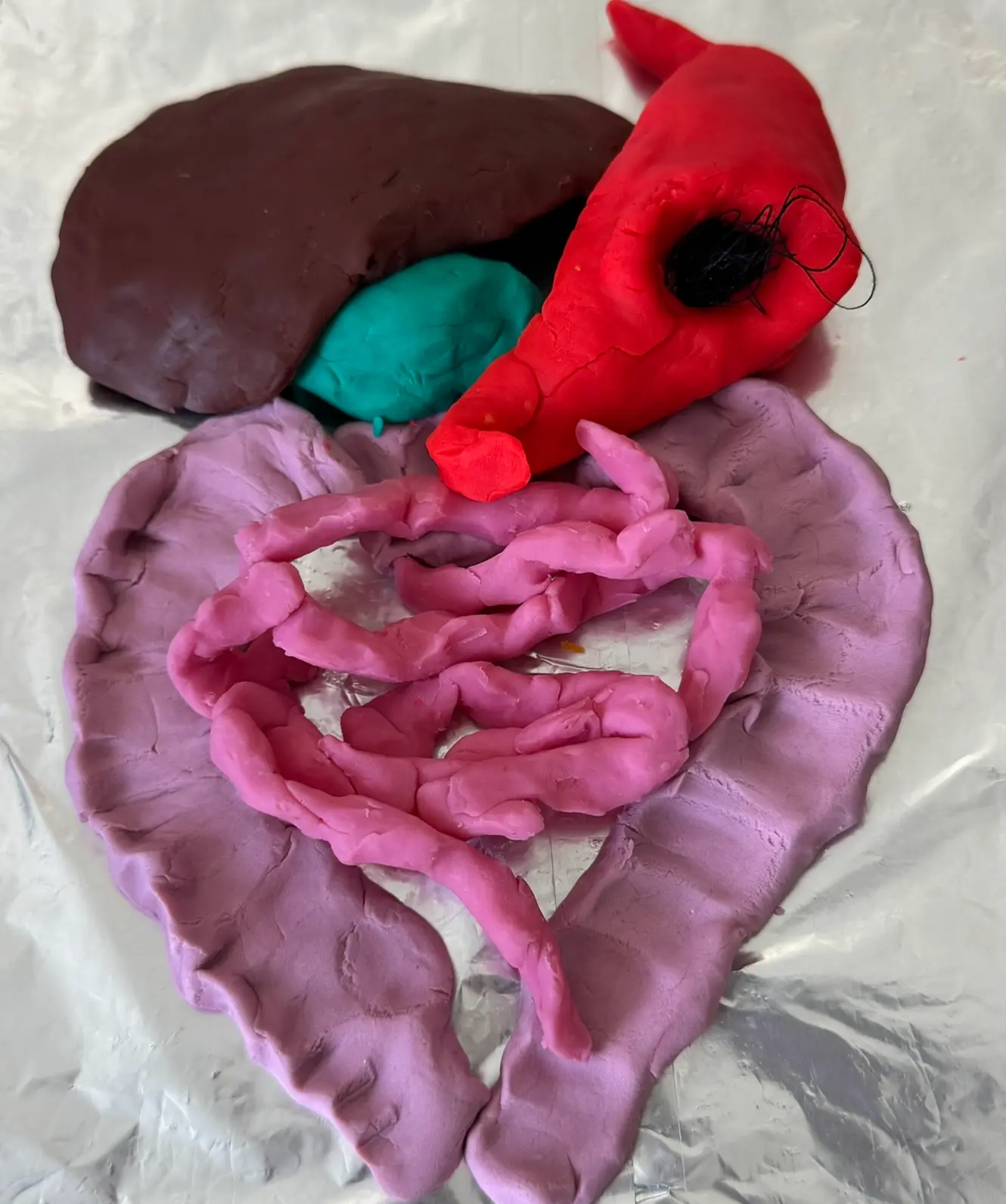 Play-dough stomach with a trichobezoar (hairball) visible inside