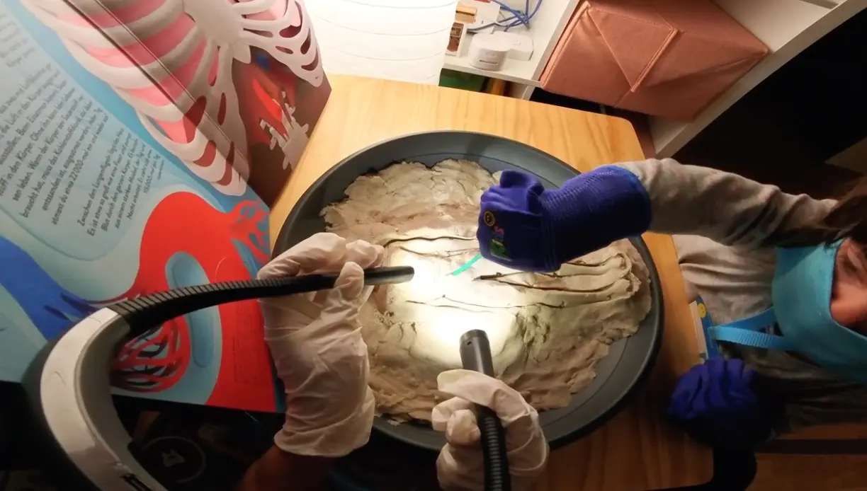 Kinetic-Sand Surgery